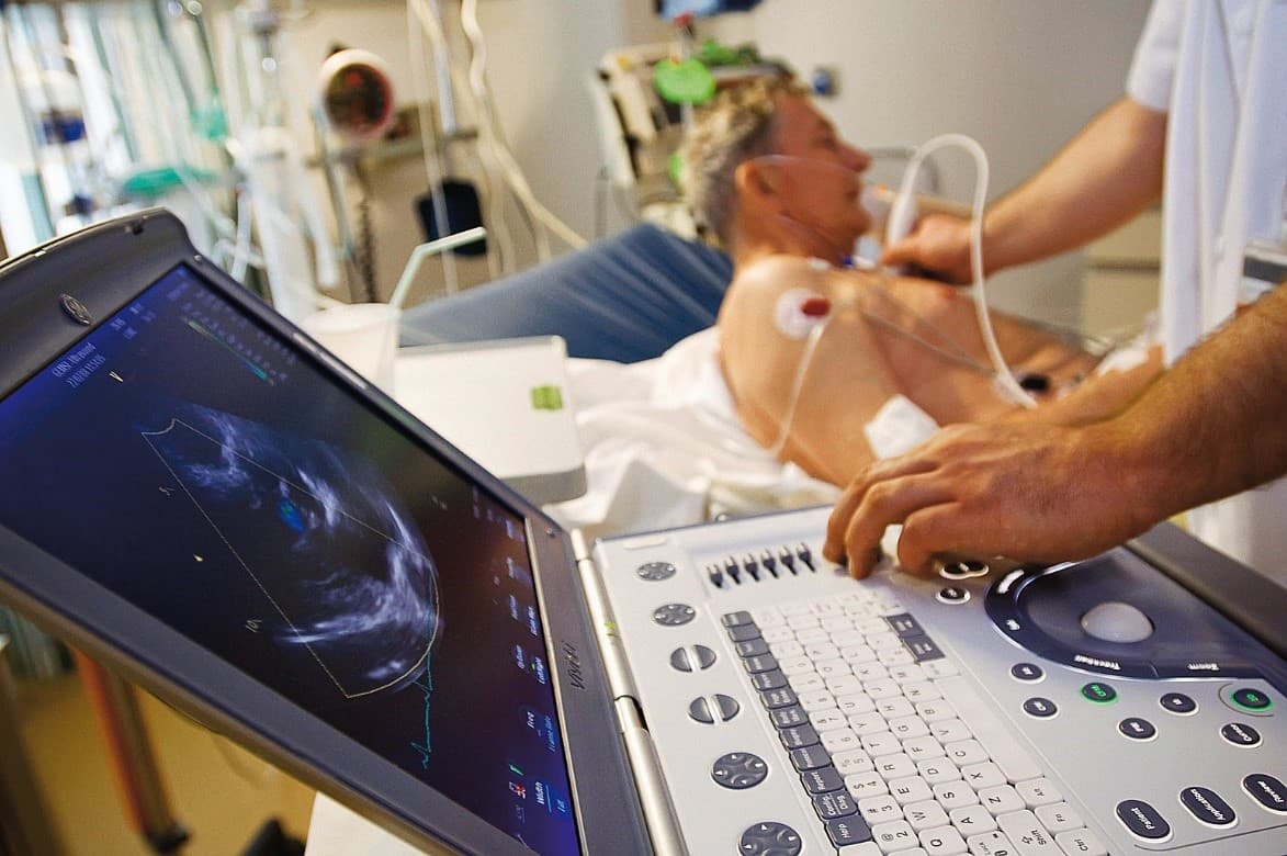 echocardiography