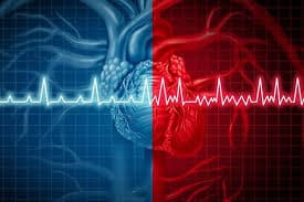 نامنظم بودن ریتم قلبی ( فیبریلاسیون دهلیزی )